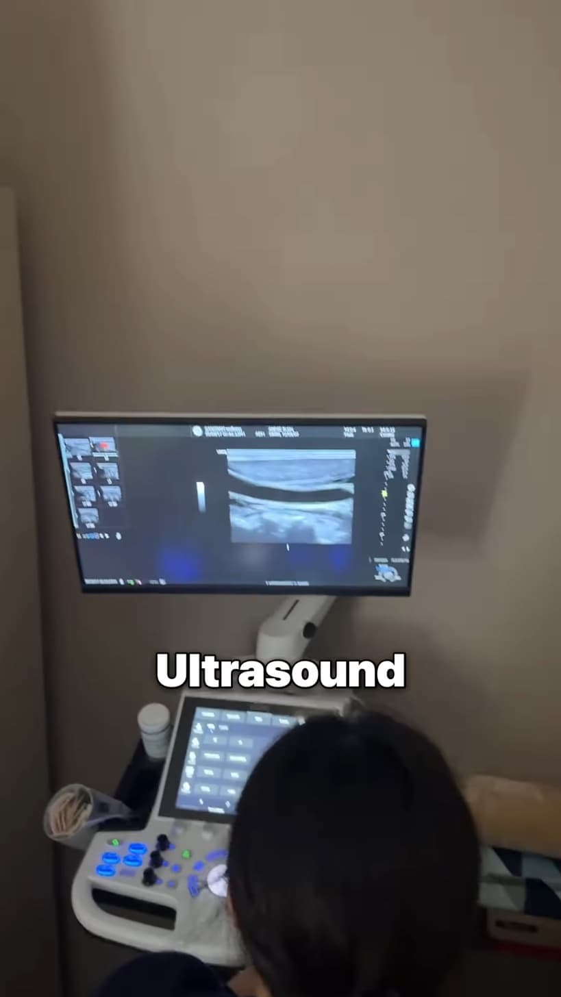 An ultrasound monitor showing a live scan in a dim exam room.