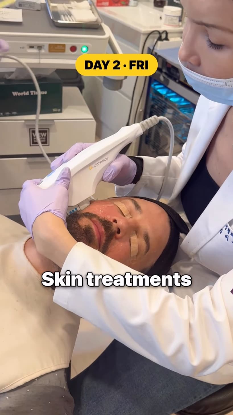 A clinician holding an Ultherapy handpiece against Kyle Istook's face.
