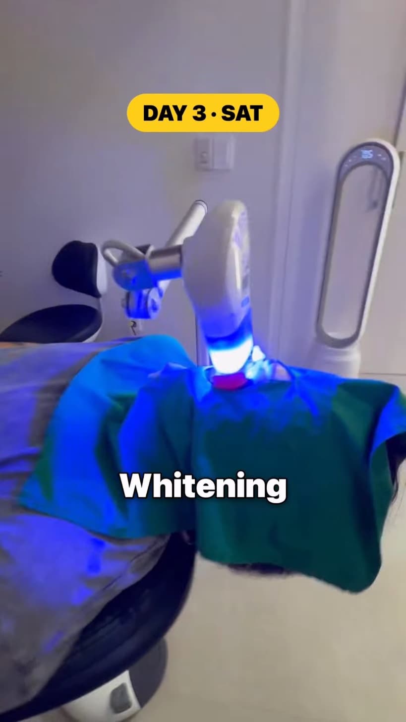 A dental whitening lamp glowing blue over a patient draped in a green cloth.